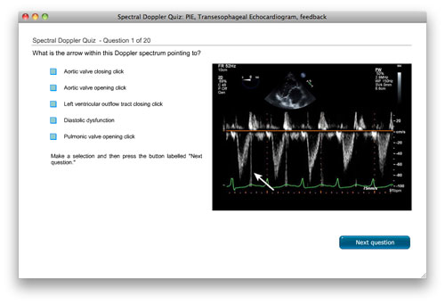 spectral doppler quiz image